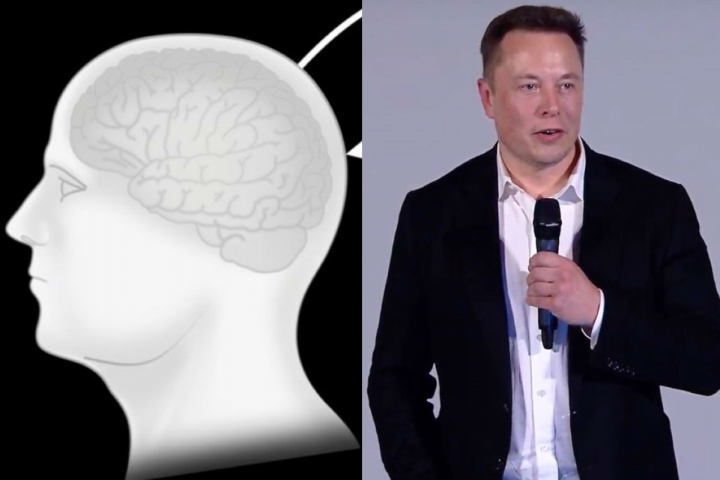 Neuralink: Elon Musk colpisce ancora
